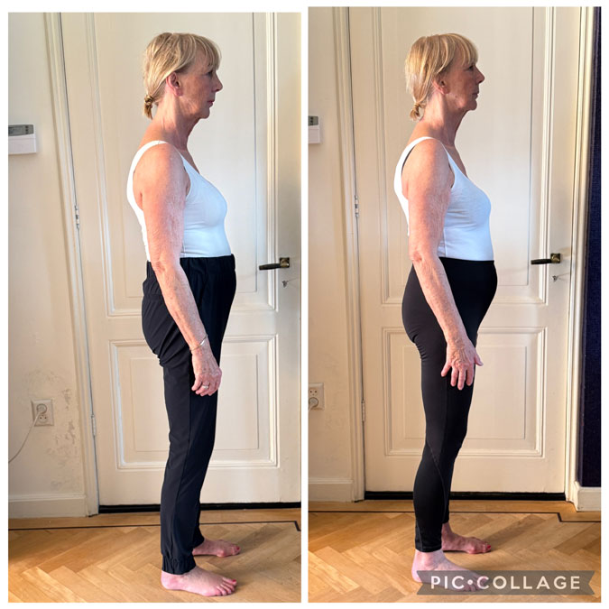 Left: old posture. 
Right: new posture after 19 days.